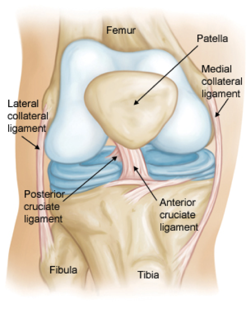 A) MRI findings: the typical bunched medial collateral ligament (MCL)